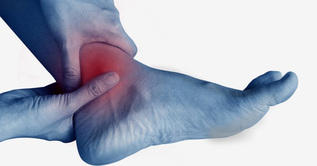 Ankle Swelling .. Symptoms, Causes and Treatments |  Health