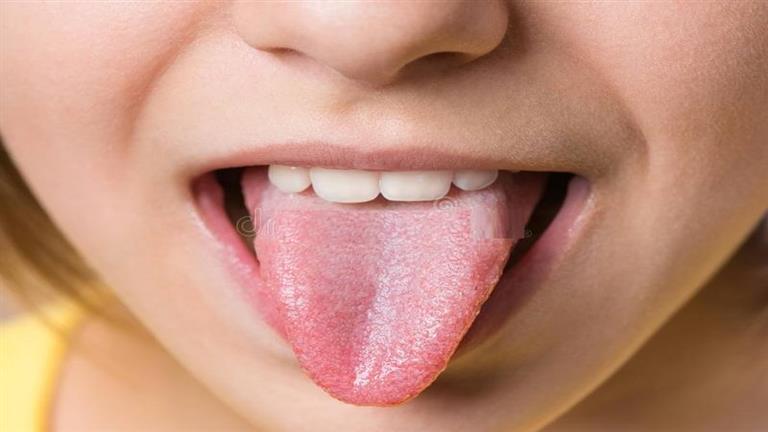 Your health during Ramadan .. A symptom on the tongue, which can indicate a dangerous medical problem