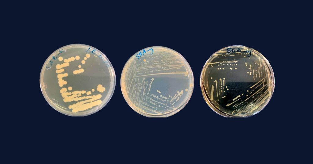 A Jordanian scientist confirms the ability of bacteria to survive and thrive in space |  Science