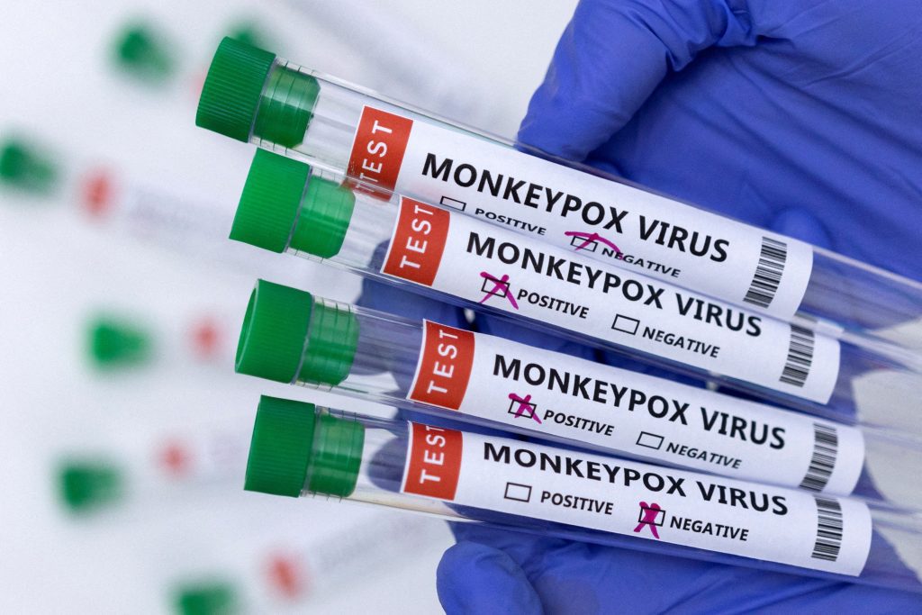 Will monkey disease become contagious?  The health system is connected