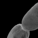 In the pictures .. Look at the largest bacteria in the world seen with the naked eye