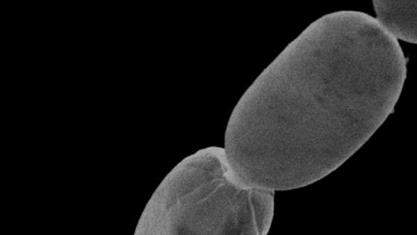 In the pictures .. Look at the largest bacteria in the world seen with the naked eye